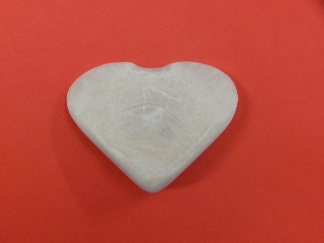 Heart-shaped urinary stone