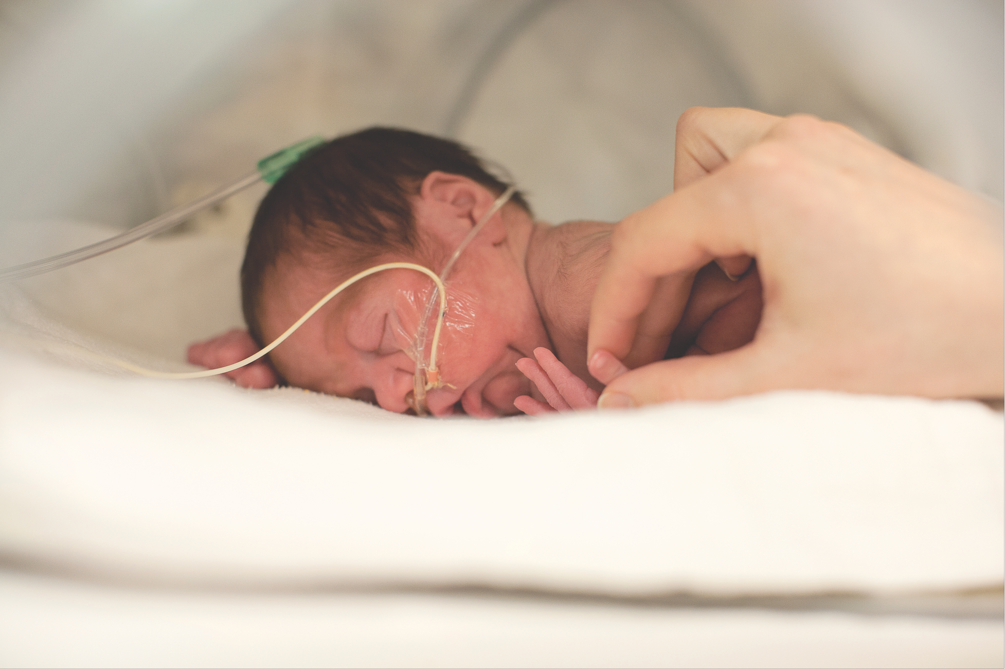 Baby with oxygen tube